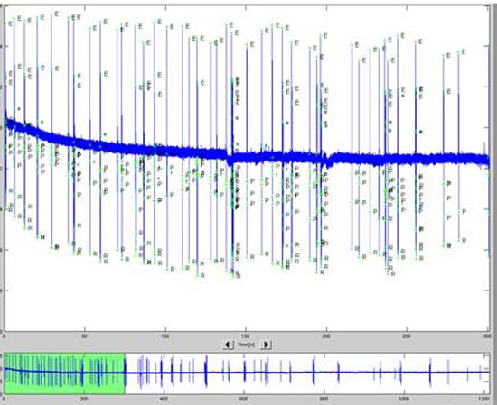 epg-annotation1